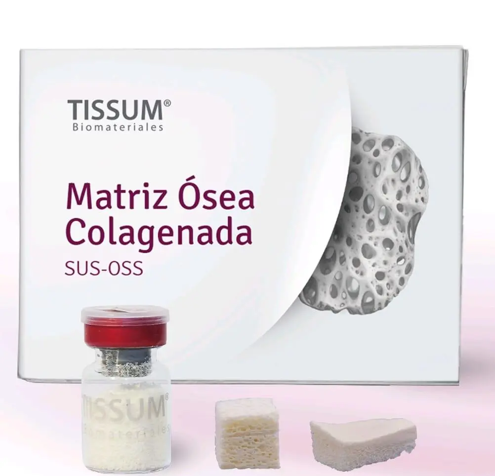 SUS-OSS INJERTO OSEO